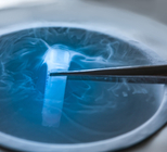 גירוי השחלות - תמונת אווירה